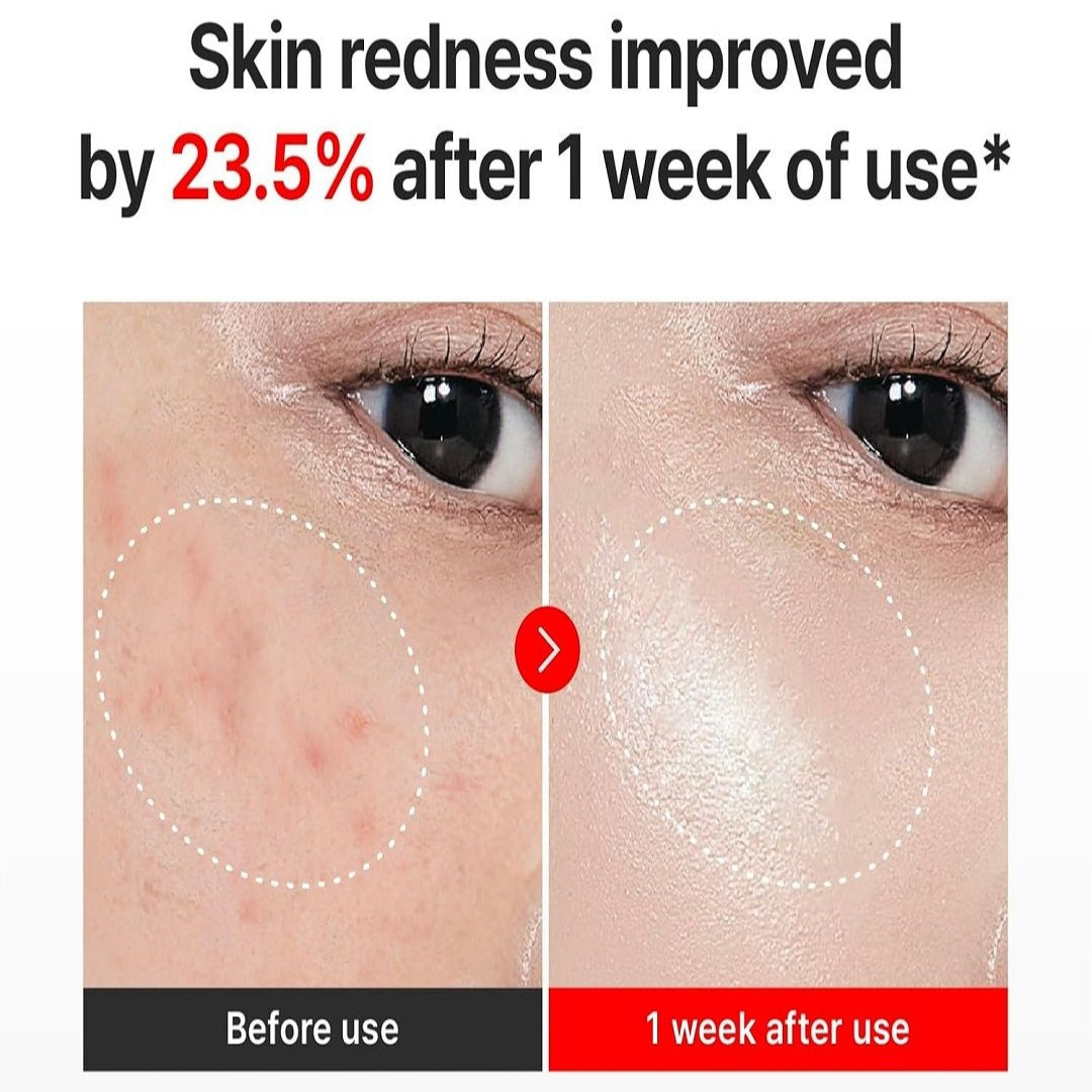 Centellian24 Madeca Cream Time Reverse 50ml - Image 3